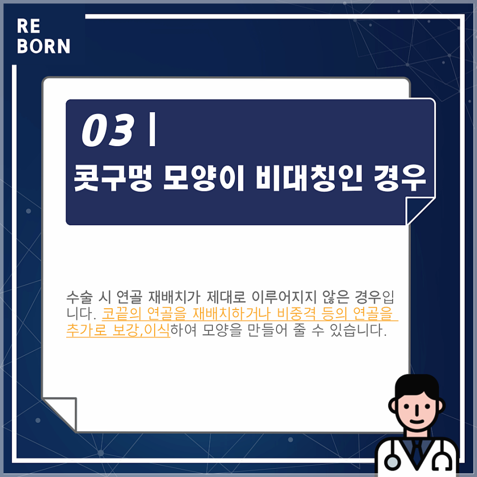 코재수술후기 좋은 리본에서 알려드리는 재수술방법! 관련 이미지 4
