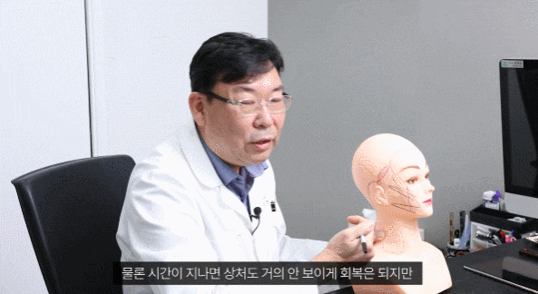 Read This Before Getting a Mini Facelift Lift image 4