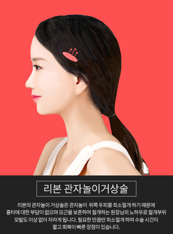 A Recommended Procedure for Those Who Feel Facelift Surgery at Sinsa Station Is Too Much image 4