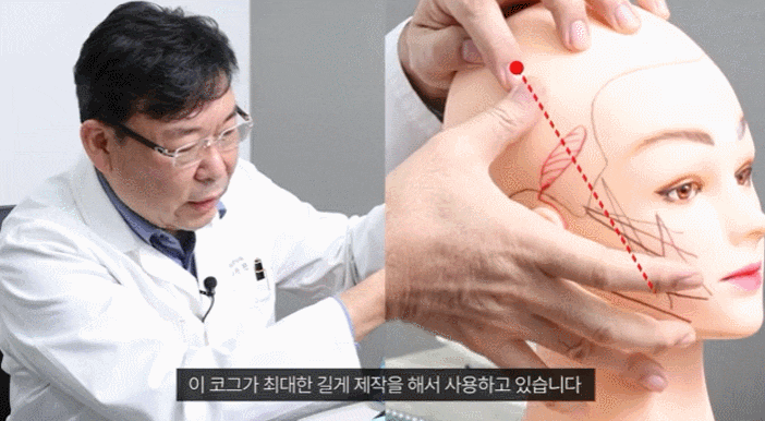 신사동 실리프팅, 여러분이 쉽게 놓치는 여러 부분들 관련 이미지 1