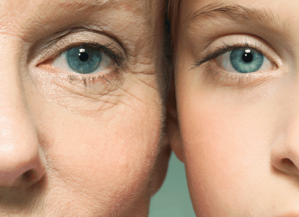 Upper and Lower Eyelid Surgery Price and Cost: How Is It Different from General Eye Surgery? image 1