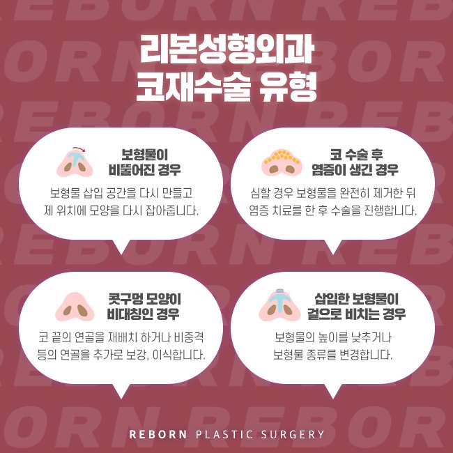 신사역코재수술 정확한 원인 파악이 우선 관련 이미지 3