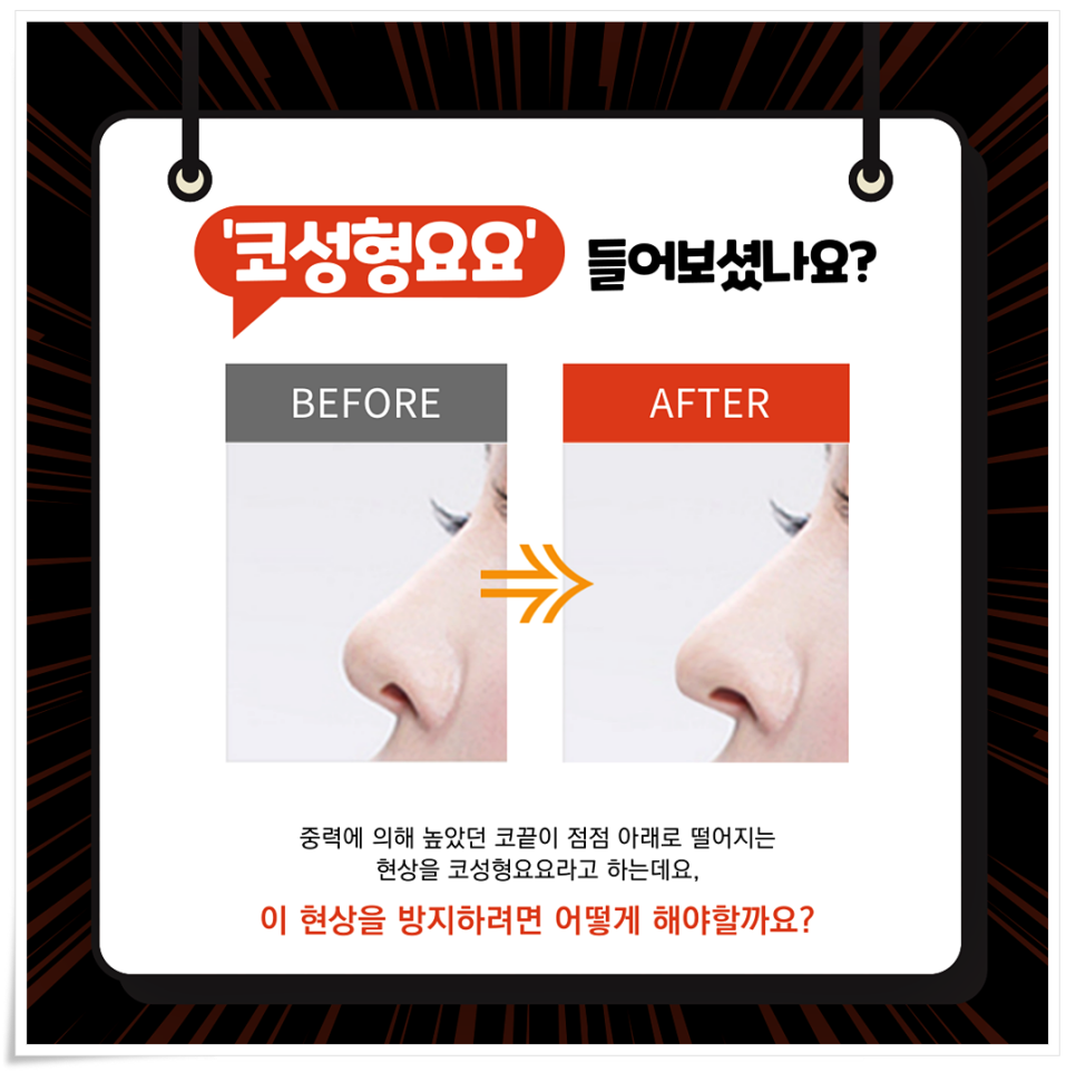코성형 부작용 참고하시길 바라요! 관련 이미지 2