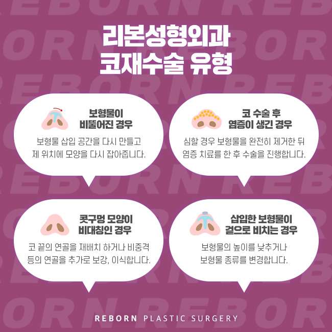 코재수술잘하는곳 신경써야 할 부분은 관련 이미지 3