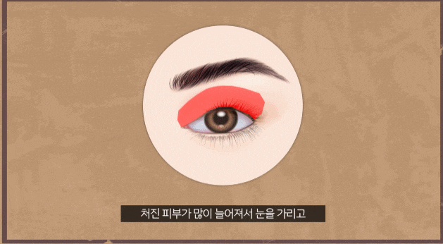 Do Not Chase Only the Price of Midlife Eye Surgery image 2