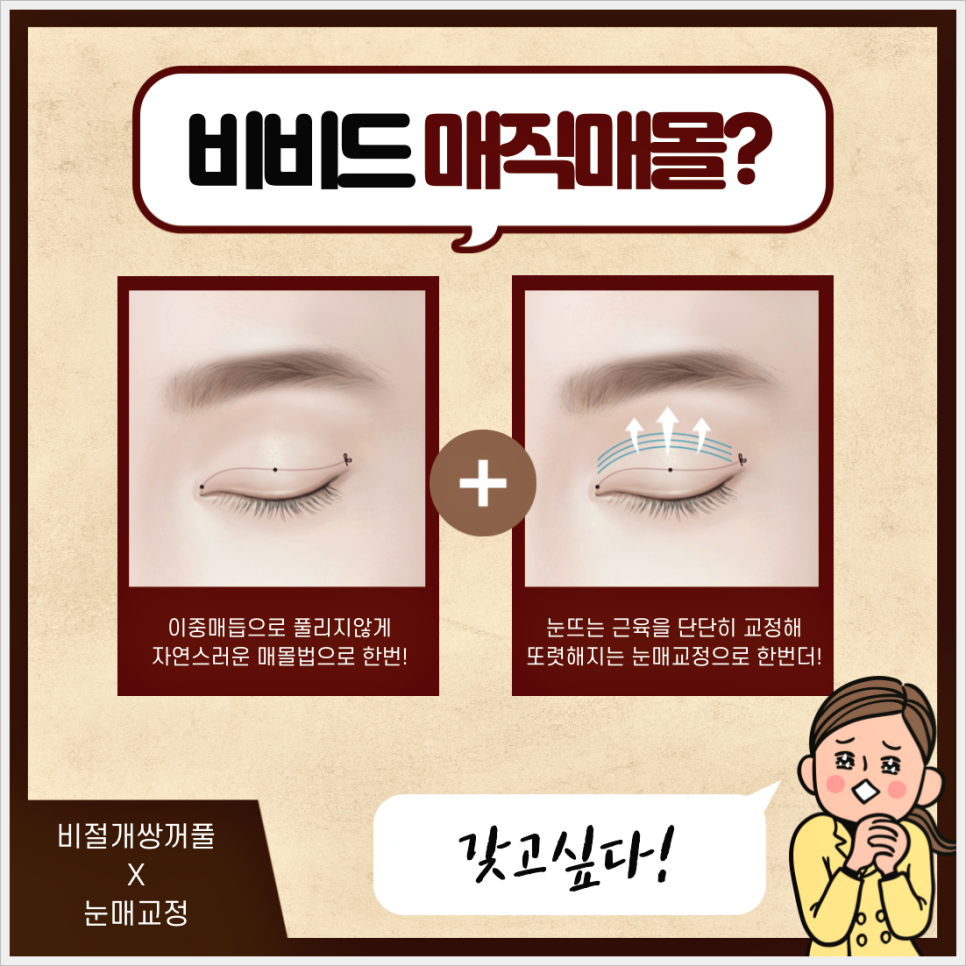 매몰재수술 피하려면 애초에 안풀리는게 좋겠죠? 비비드매직매몰! 관련 이미지 3