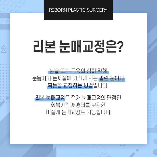 압구정역눈매교정 새롭게 트인 눈 관련 이미지 2