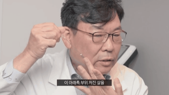 안면거상전후 후기 찾을 때 함께 살펴보세요! 관련 이미지 2