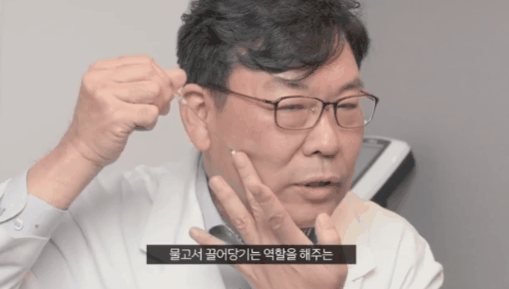 Facelift Price and Cost: How Is It Different from Thread Lifting? image 5