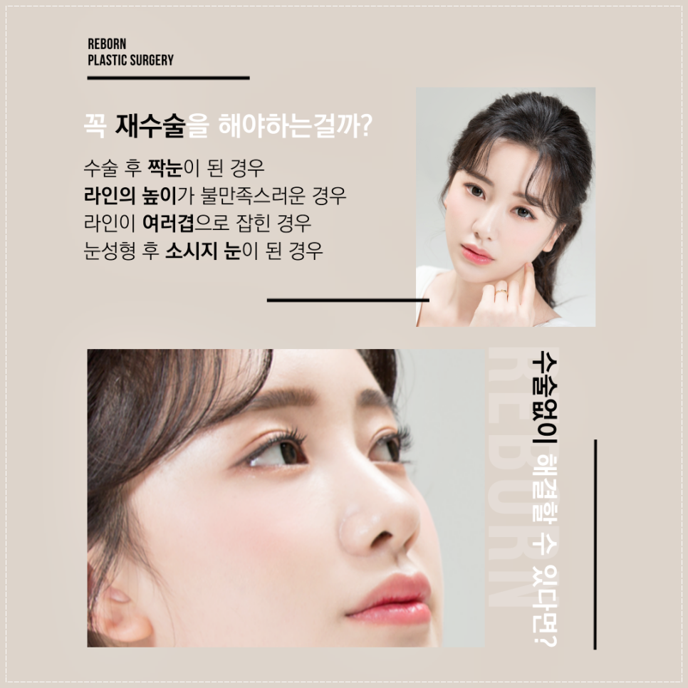 신사역쌍꺼풀 이제 재수술말아요, 리터치가 있잖아요 관련 이미지 2