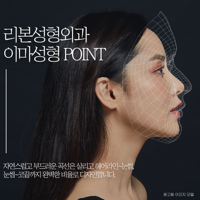 압구정성형외과 이마에 보형물을 넣을 때? 관련 이미지 4