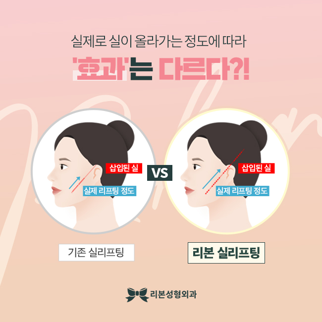 압구정역리프팅 새로운 피부와 탄력으로 관련 이미지 3