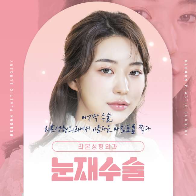 강남눈재수술 꼭 체크해야 할 포인트 관련 이미지 1