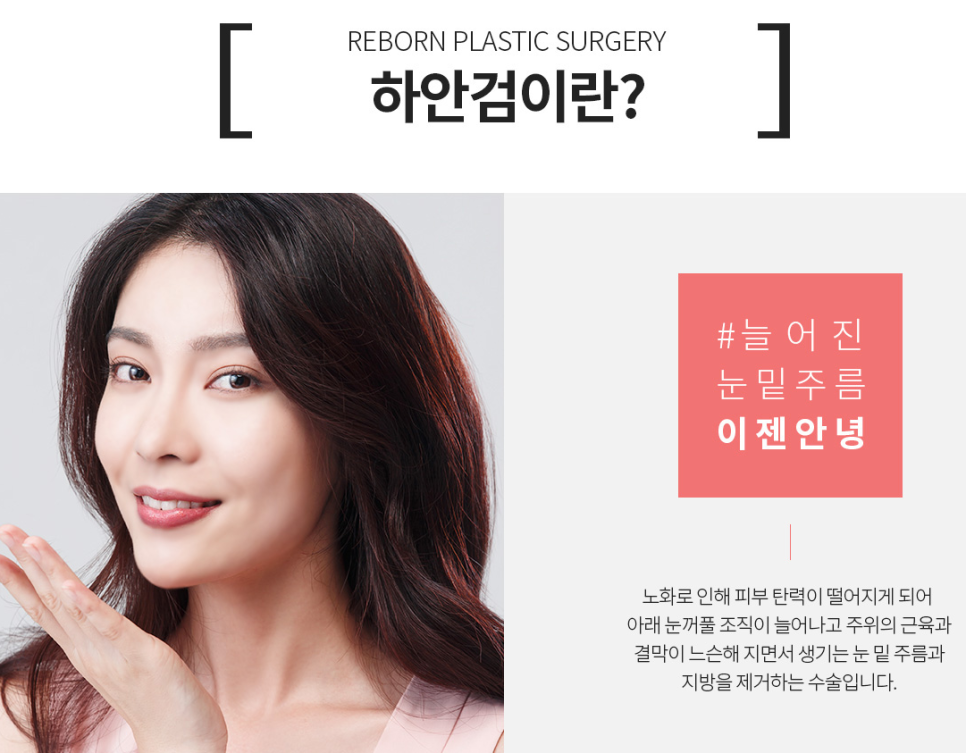 신사 중년눈성형 후기 처진눈을 올려라! 관련 이미지 3