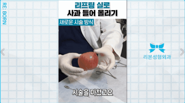 중안부실리프팅 후기 전후사진 보고 시술 결정하지 마세요 관련 이미지 3