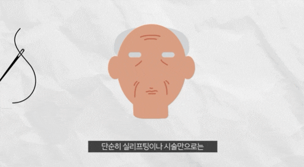 신사동 안면거상술 유명한곳? 피부만 당기면 실패할 확률 높습니다. 관련 이미지 4