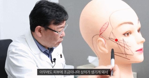 신사동 실리프팅 관련 이미지 4