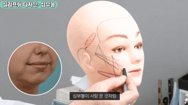 Why You Shouldn’t Decide on Midface Lift Cost Based Only on Price image 3