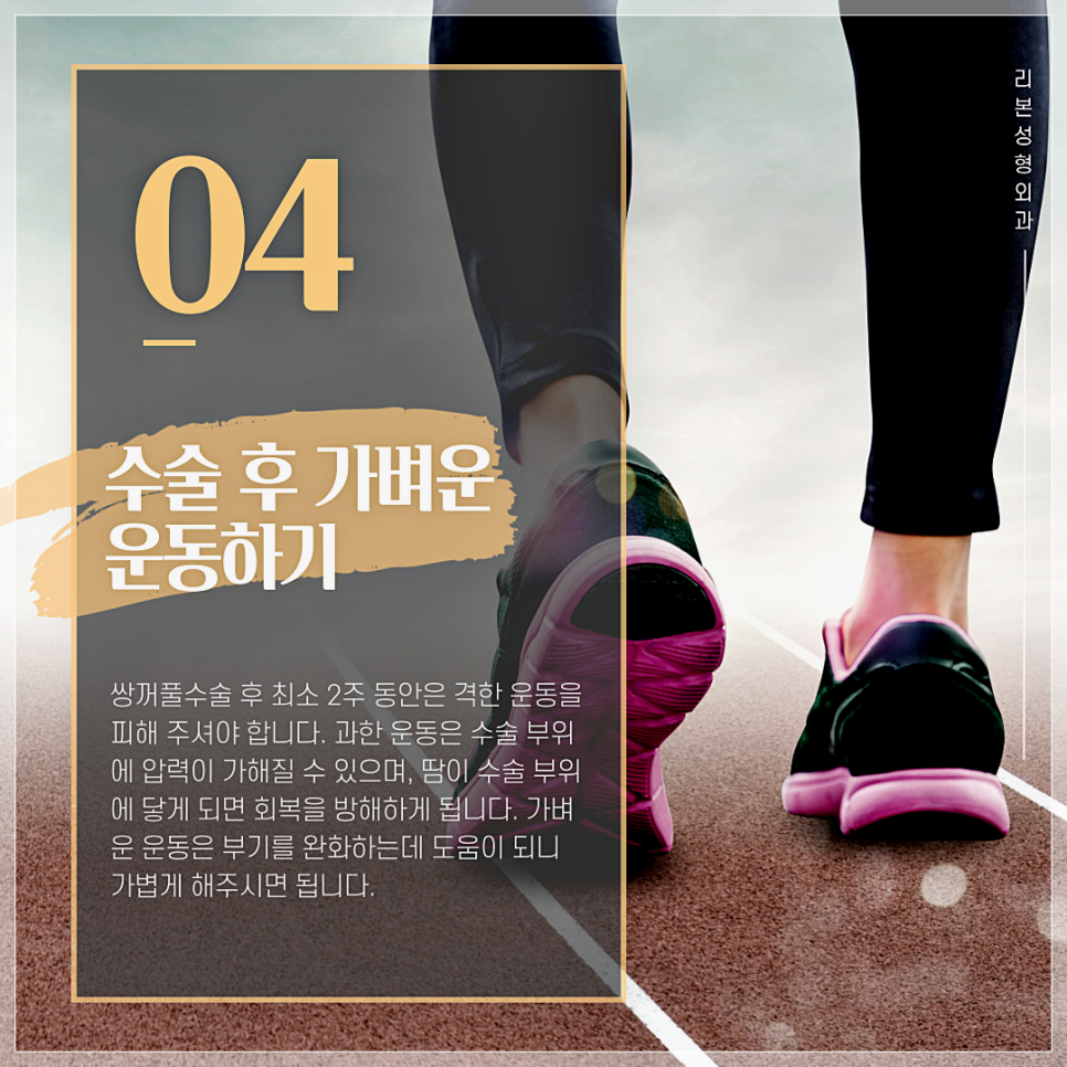 쌍꺼풀수술전후 이것은 꼭! 기억해두세요! 관련 이미지 5