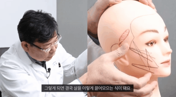 For Those Planning a Face Sagging Procedure image 1