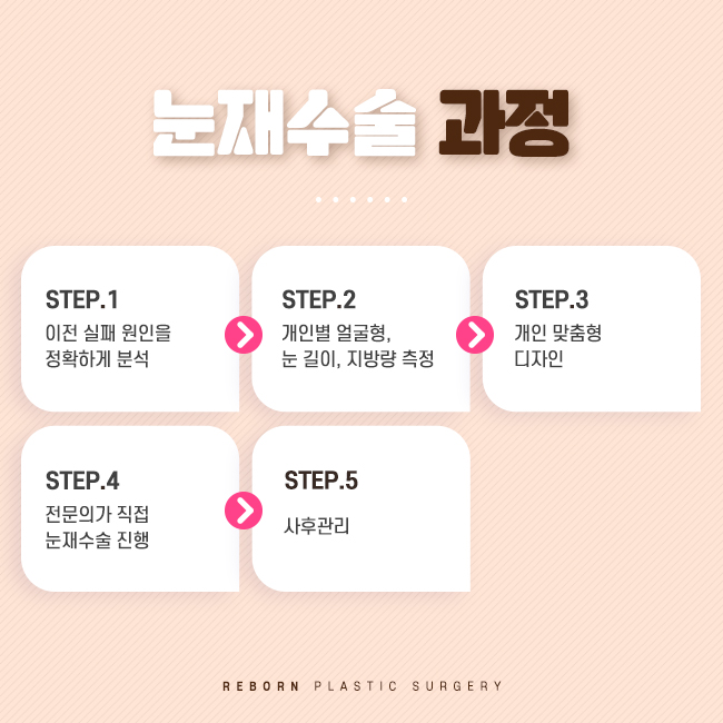 압구정역성형외과 마지막 눈재수술, 시작 관련 이미지 2