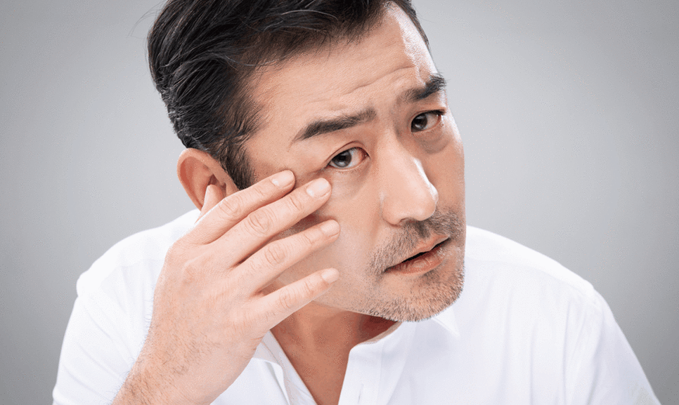 Upper and Lower Blepharoplasty Costs and Prices: Precautions Before and After Surgery and What Is the Recovery Period? image 3