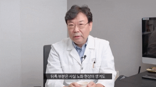 졸린 눈 수술 눈매교정? 쌍수? 어떤 걸 해야 할까 관련 이미지 4