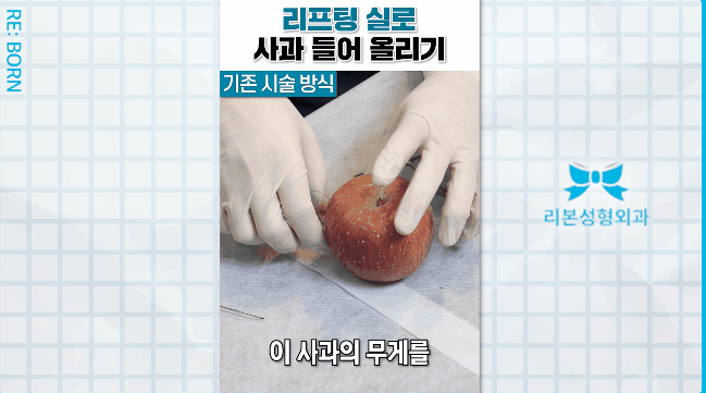 중안면 리프팅 성형외과, 중안면부 처짐, 꺼짐, 볼륨감소 고민이라면 관련 이미지 4