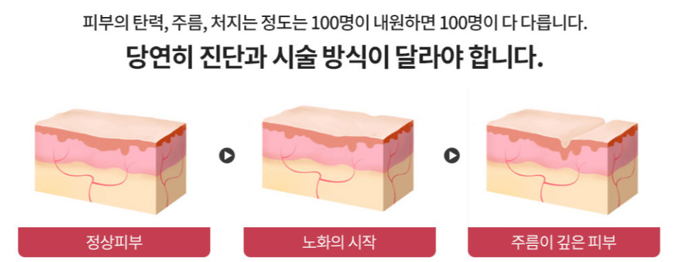 깊은 팔자주름 시술 성형외과 찾는 분들은 꼭 읽어주세요 관련 이미지 4