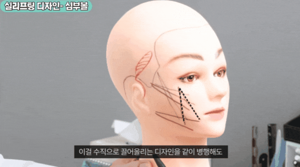 얼굴 실리프팅 가격, 비용만 보고 결정하면 안 됩니다 관련 이미지 4