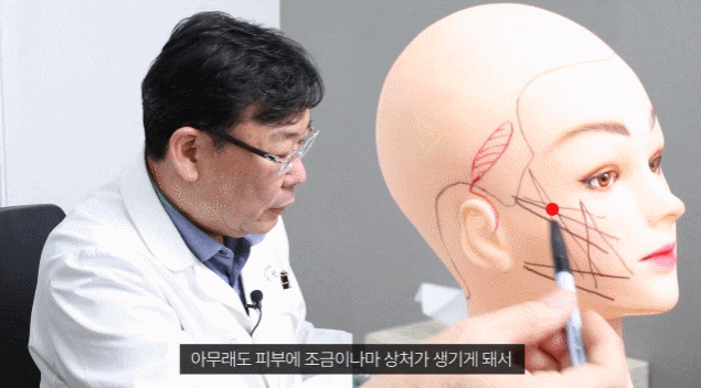 미니리프팅효과 제대로 못 보셨던 분들은 필독하세요 관련 이미지 1