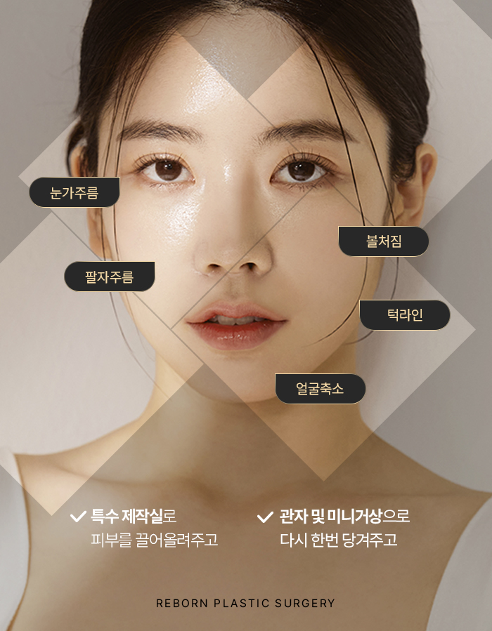 강남 안면거상술 후기, 얼굴 전반적 처짐개선에 효과적 관련 이미지 4