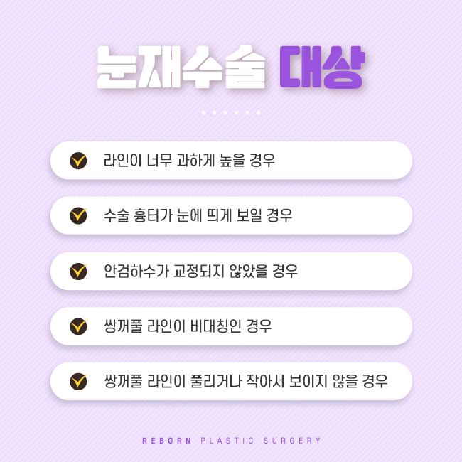 압구정눈재수술 다시 수정해야 할 때 관련 이미지 3