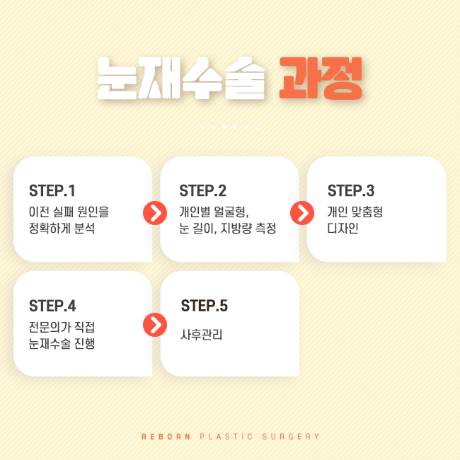 신논현성형외과 눈의 마지막 변화 관련 이미지 2