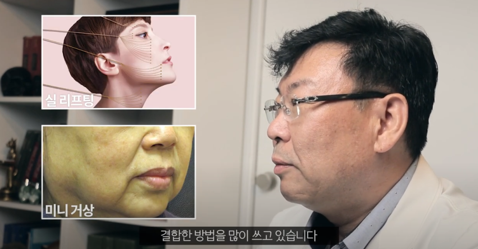 미니안면거상 리본성형외과에서 가심비 저격한 이유! 관련 이미지 5