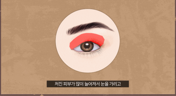 A Good Plastic Surgery Clinic Near Sinsa Station for Upper Blepharoplasty image 2