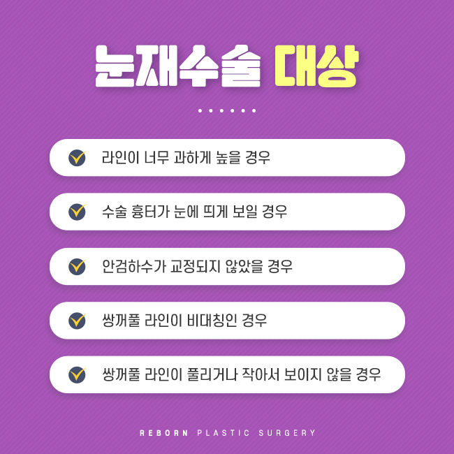 논현눈재수술 이제 실패는 안하도록 관련 이미지 3