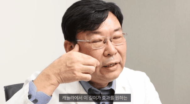 Facelift Price and Cost: Why Thread Lifting Deserves More Attention image 4