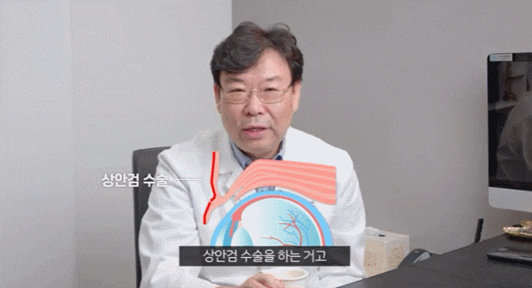 신사 눈매교정 잘하는 곳은 무엇이 다를까요? 관련 이미지 1