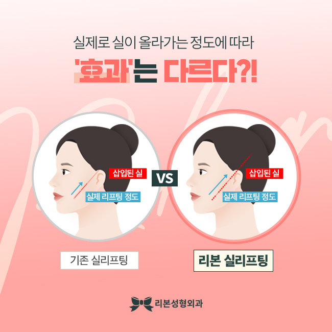 강남역성형외과 달라진 내 모습 관련 이미지 3