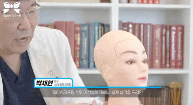 신사역안면거상 부작용, 회복기간, 흉터 걱정되는 분들은 확인하세요. 관련 이미지 4