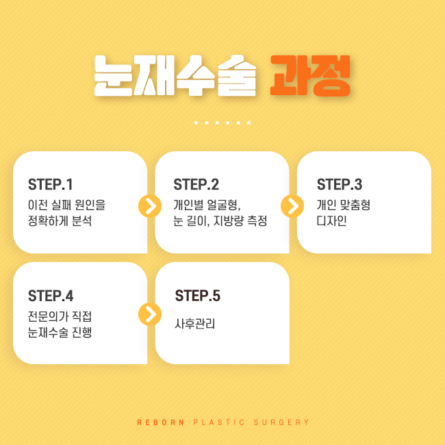 강남역눈재수술 성공을 위한 관련 이미지 2
