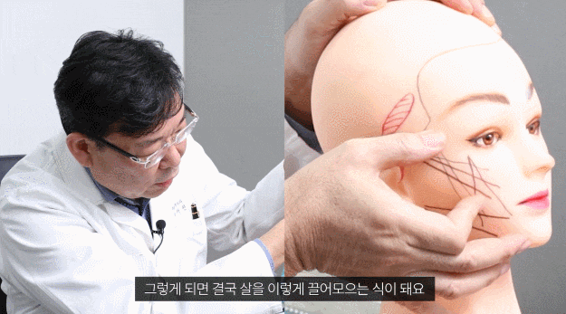 신사역 실리프팅 효과 기대 이하였던 경험이 있다면? 관련 이미지 2