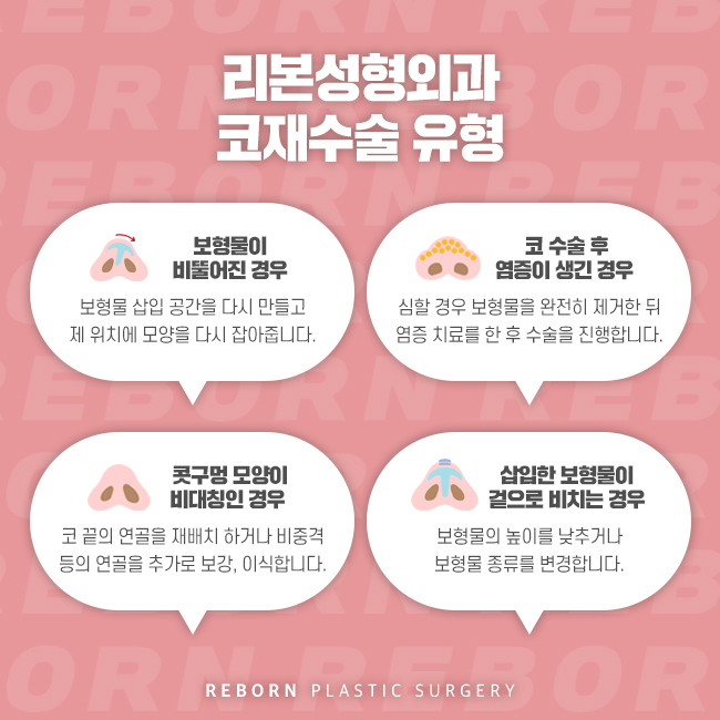 신논현코재수술 코를 다시 한번 관련 이미지 3