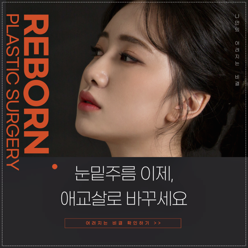눈밑주름없애는방법 리본에서 하안검성형으로! 관련 이미지 1