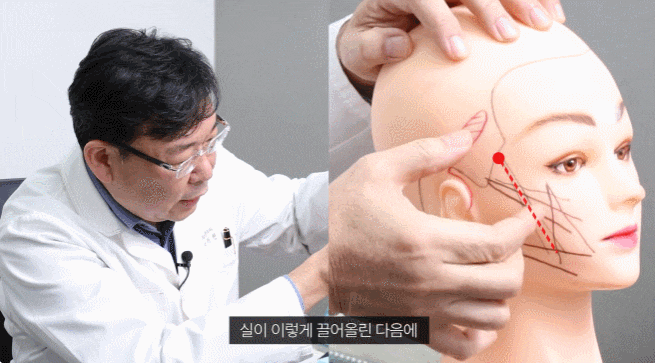 논현 실리프팅 잘하는 성형외과 관련 이미지 3