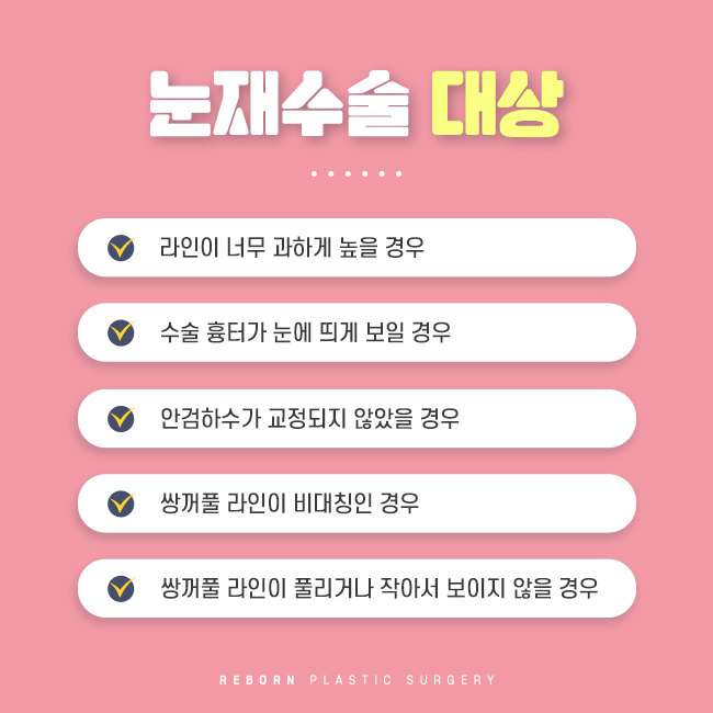 강남눈재수술 꼭 체크해야 할 포인트 관련 이미지 3