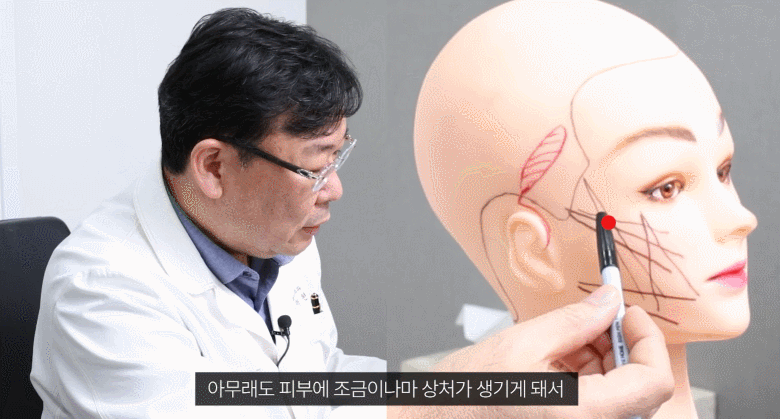 관자놀이리프팅 거상 받기 전에 필독해주세요 관련 이미지 4