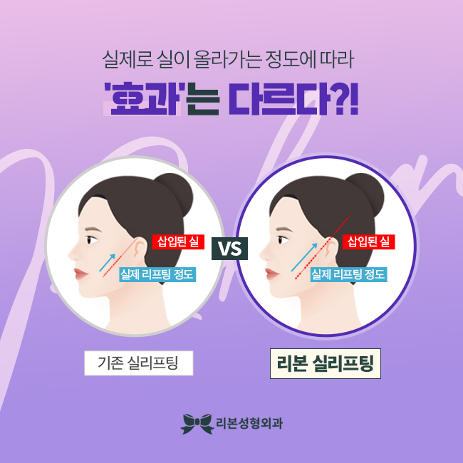 신논현역리프팅 만족할 수 있도록 관련 이미지 3