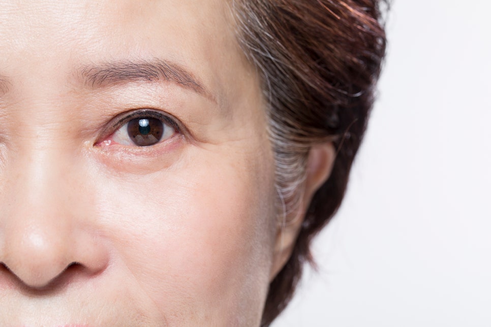 Blepharoplasty Review in Sinsa, for Those Looking for Before-and-After Photos... image 3